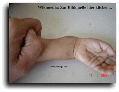 C:\Users\Bertram\Desktop\Tierarzt Mnster - Dr.
                    Heiko Delorme - Homopathie bei Tieren! 0251 -
                    797877_files\rickets.gif